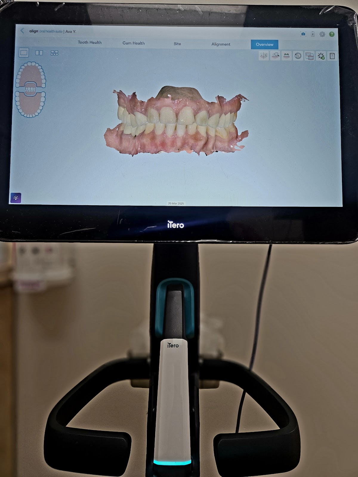 Allure Dentistry gallery 6