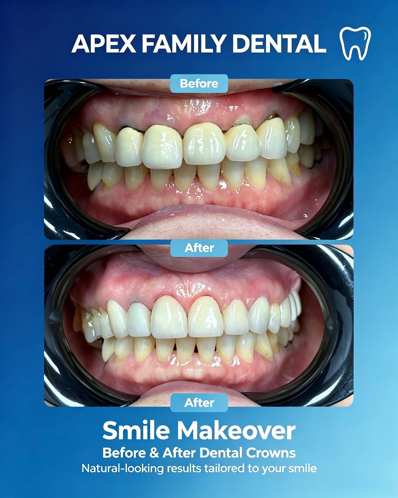 Apex Family Dental PC gallery 2