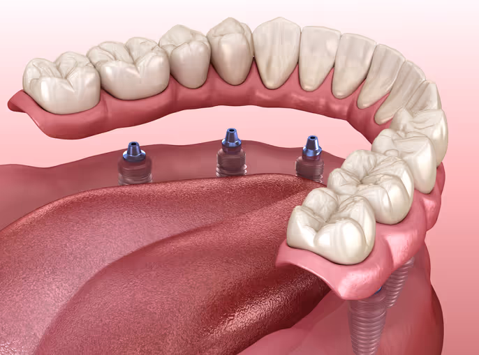 Central Park Dentistry - Cosmetic Dentists gallery 2