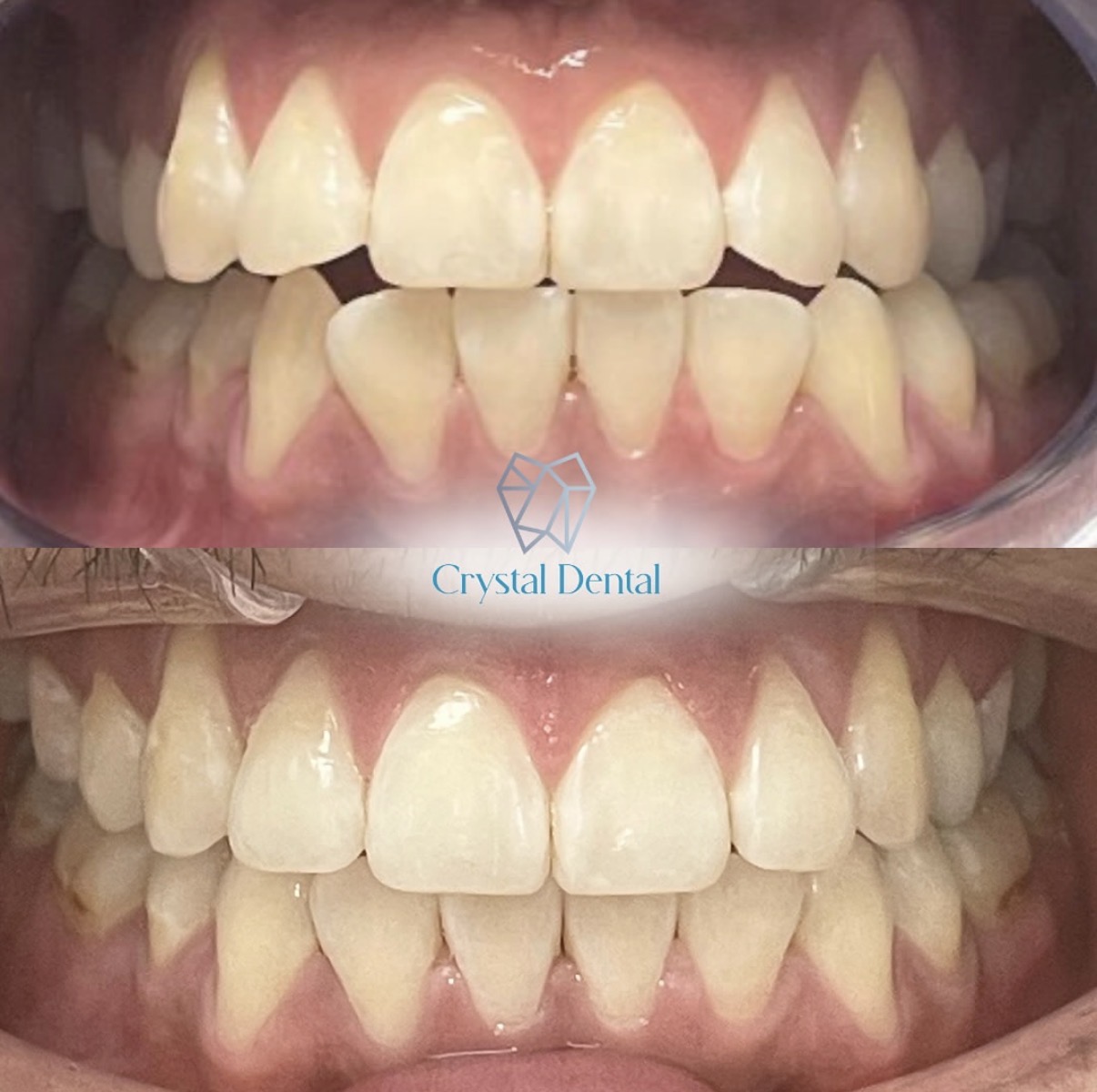 Crystal Dental gallery 4