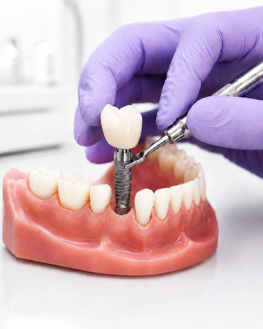 Deluxe Dentistry-General Dentistry-Cosmetic-Dental Implants-Sedation-Emergency Dental Care gallery 6