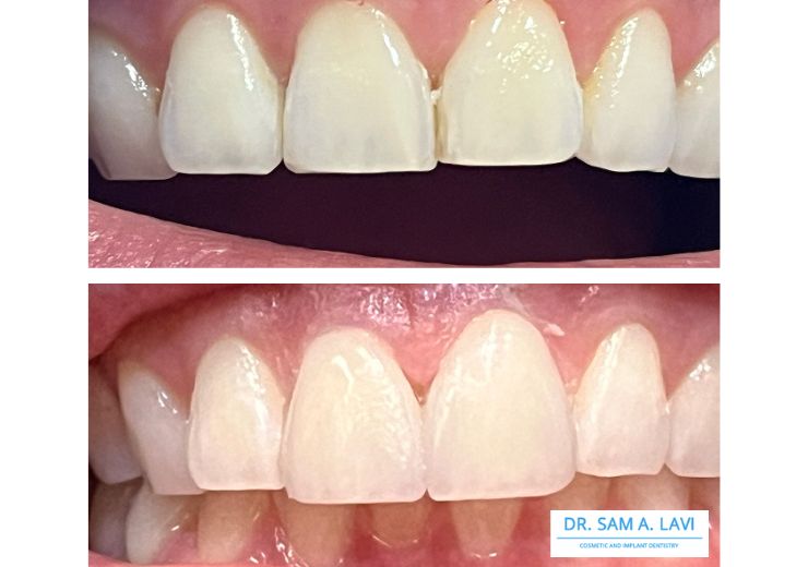 Dr. Sam Lavi Cosmetic and Implant Dentistry gallery 2