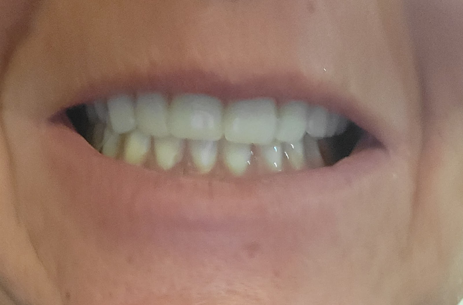 Gadsden Family Dentistry gallery 2
