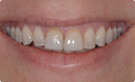 Geller Dentistry gallery 4