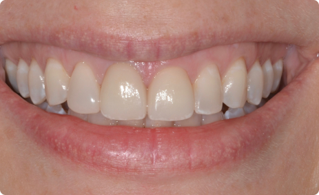 Geller Dentistry gallery 5