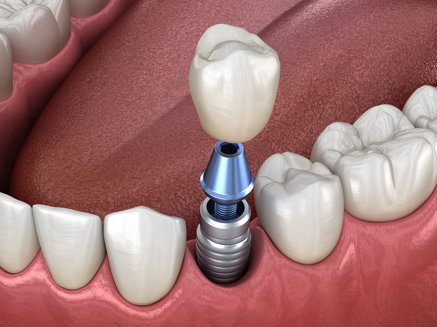 Gentle Dentistry gallery 4