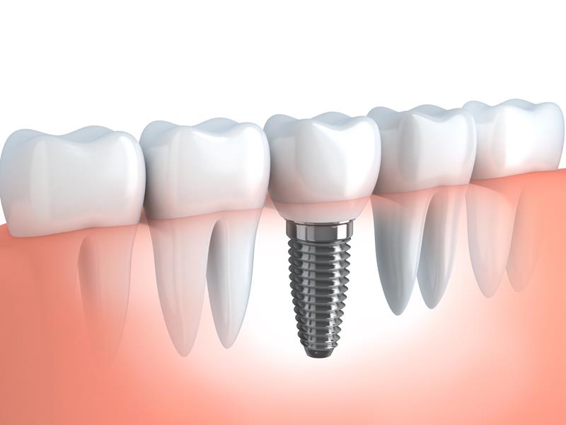 George D. Lim, DMD Inc. Dentistry & Orthodontics gallery 5