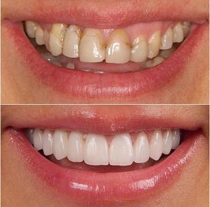 Monterey Hills Dental gallery 3