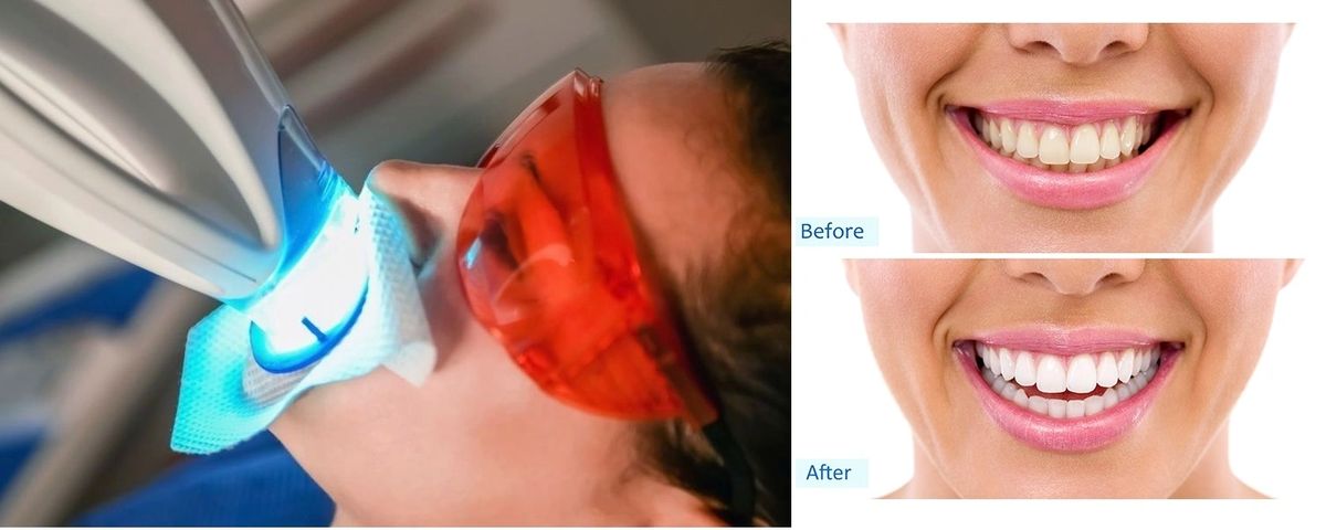 Monterey Hills Dental gallery 5