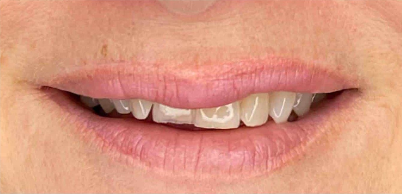 Smiles By Dr. Levine Kendall Park gallery 1