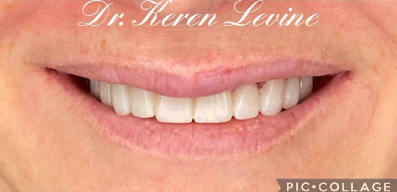 Smiles By Dr. Levine Kendall Park gallery 2