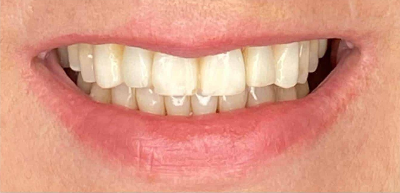 Smiles By Dr. Levine Kendall Park gallery 3