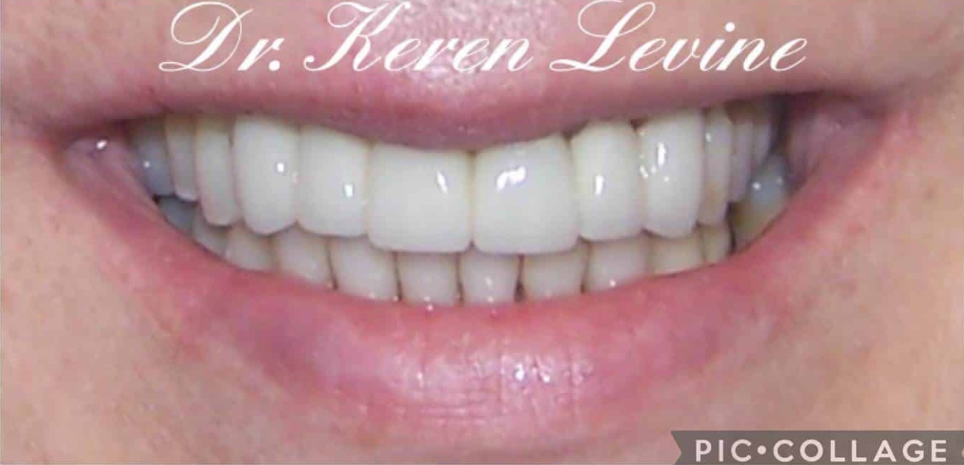 Smiles By Dr. Levine Kendall Park gallery 4