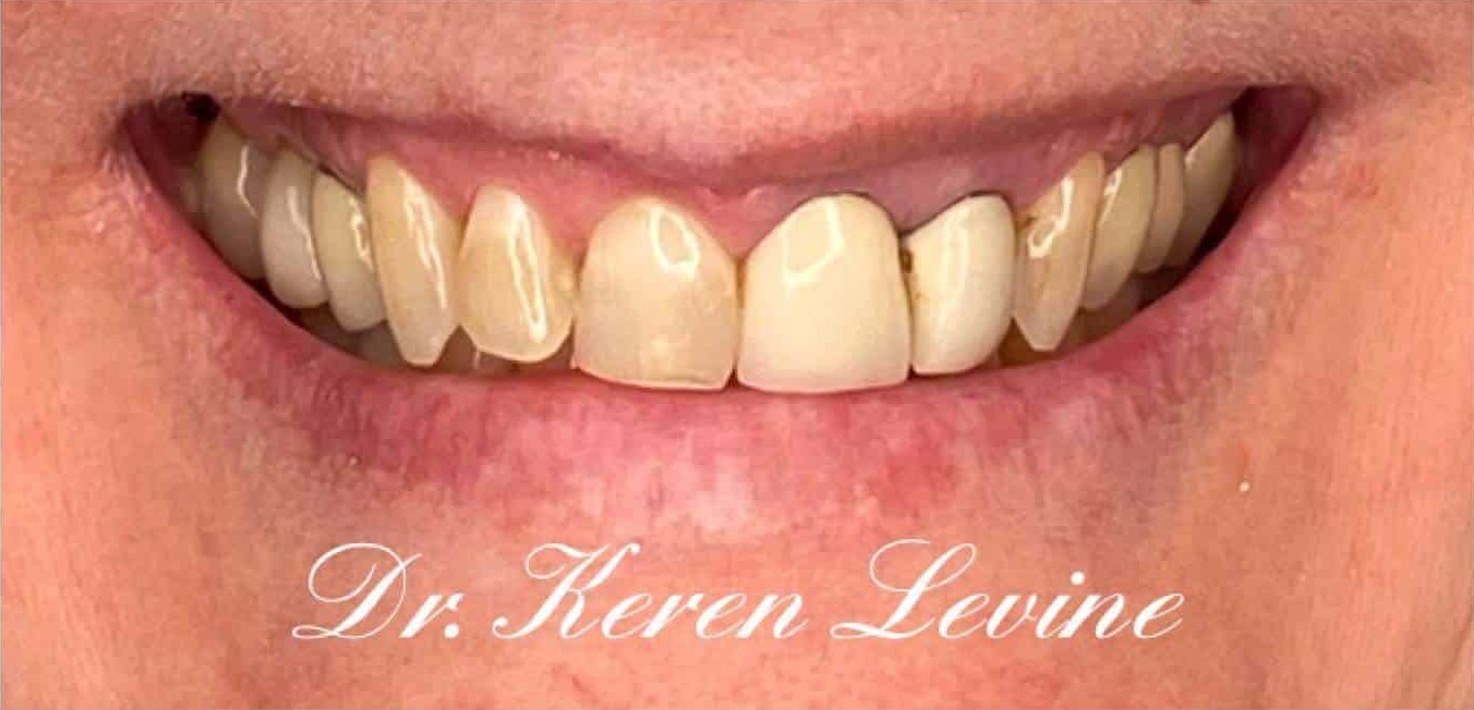 Smiles By Dr. Levine Kendall Park gallery 5