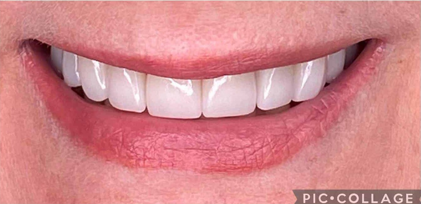 Smiles By Dr. Levine Kendall Park gallery 6