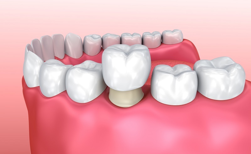 Sumiton Family Dentistry gallery 3