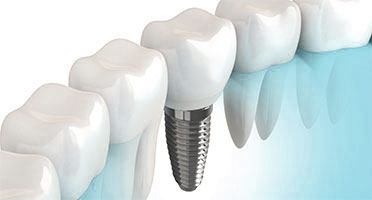 Wall Street Dentistry gallery 4