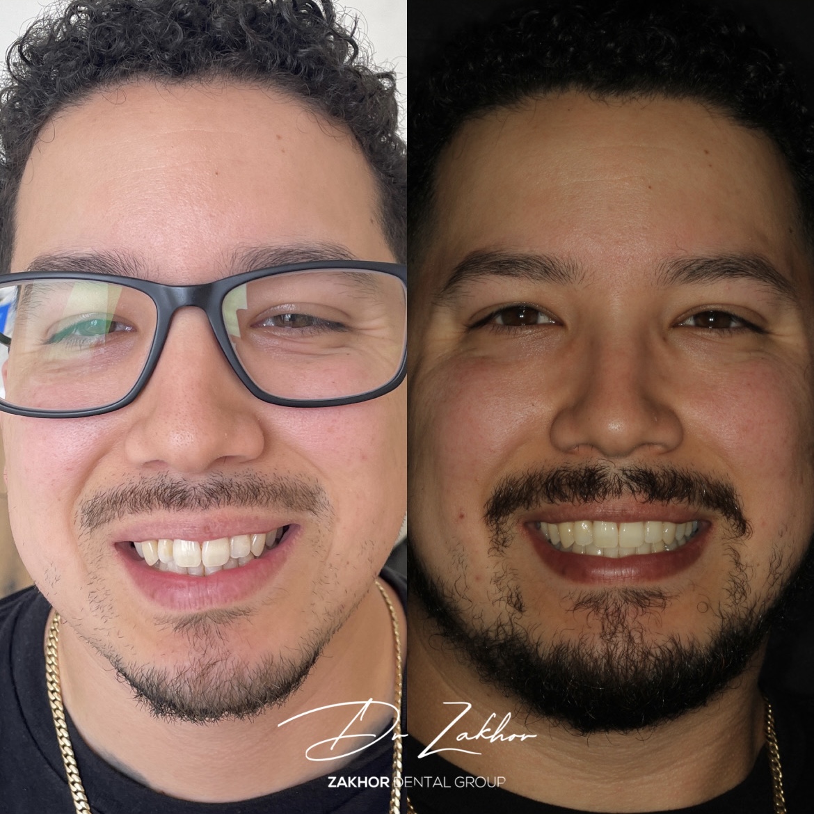 Zakhor Dental Group- Beverly Hills cosmetic dentist gallery 2