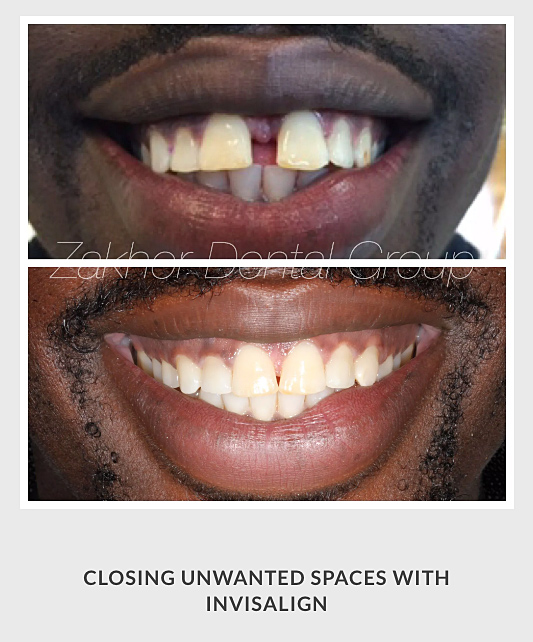 Zakhor Dental Group- Beverly Hills cosmetic dentist gallery 3