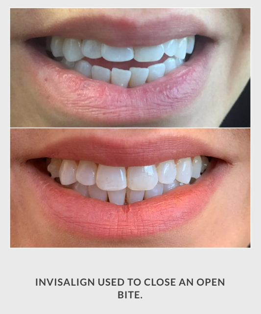 Zakhor Dental Group- Beverly Hills cosmetic dentist gallery 4