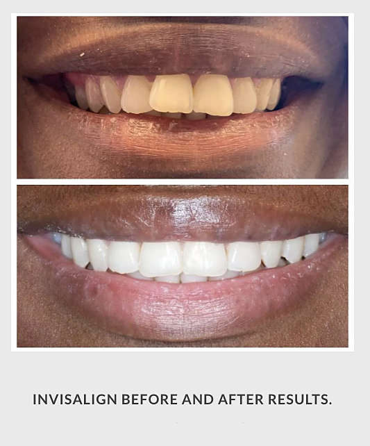 Zakhor Dental Group- Beverly Hills cosmetic dentist gallery 5