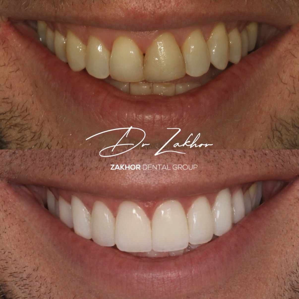 Zakhor Dental Group- Beverly Hills cosmetic dentist gallery 6