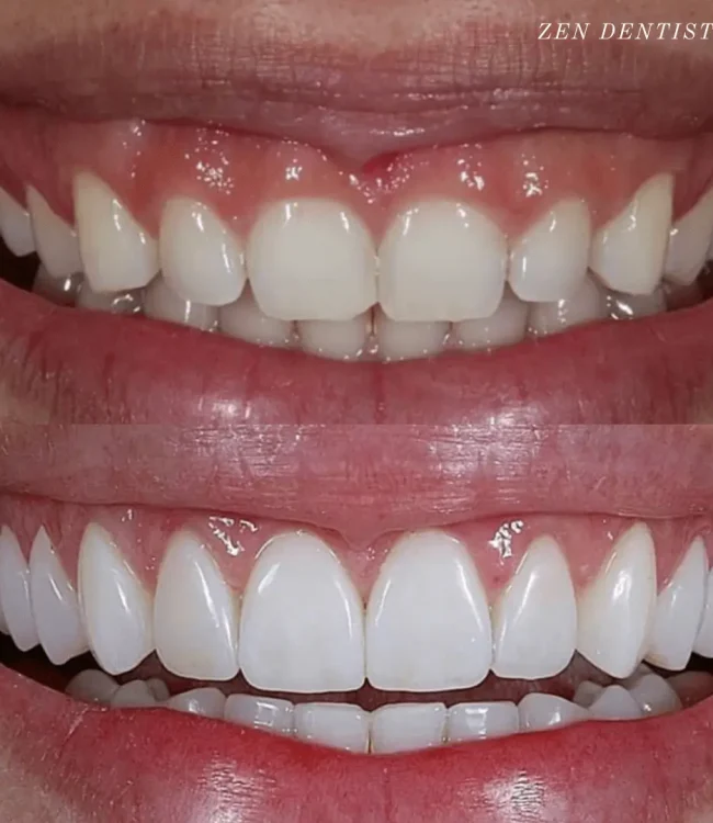 Zen Dentistry - FiDi gallery 2