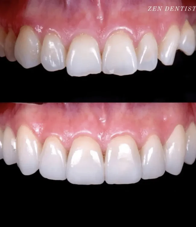 Zen Dentistry - FiDi gallery 3