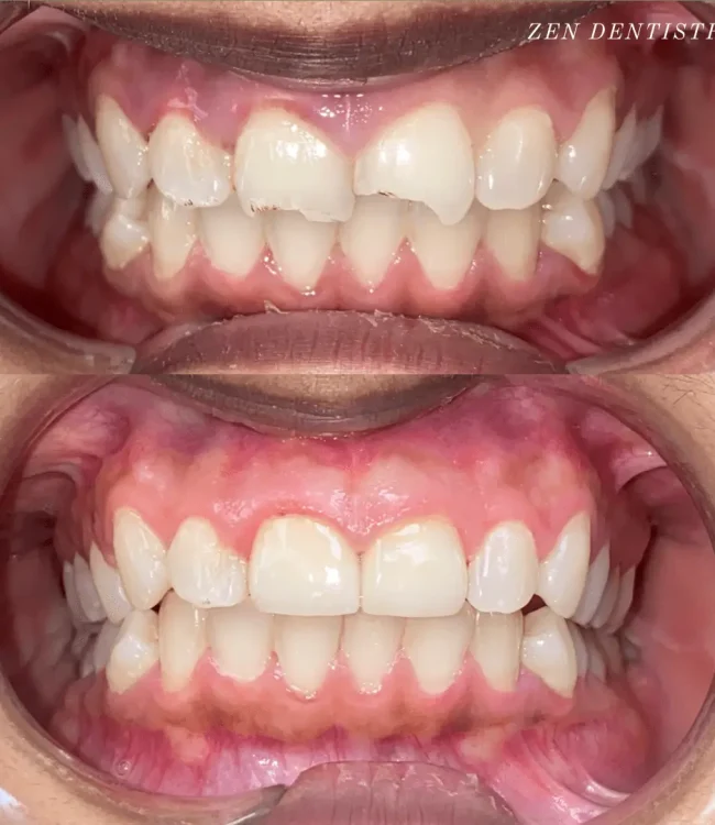 Zen Dentistry - FiDi gallery 4